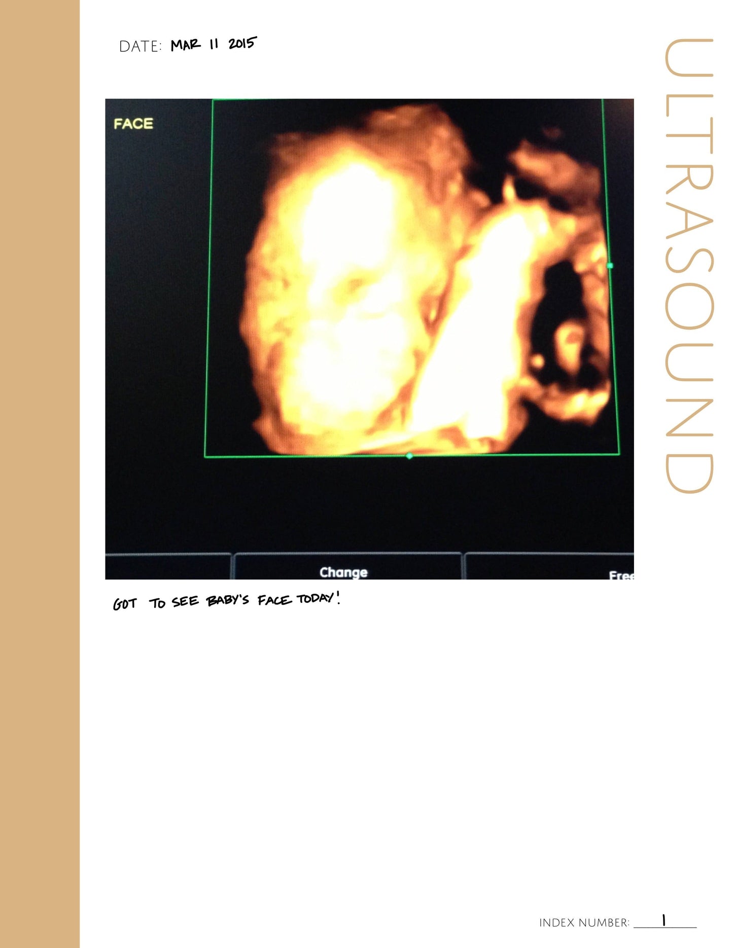 Ultrasound Bundle: Printable Genealogy Form (Digital Download)